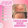 TapeTox Face Tape for Wrinkles  480 Pre-Cut Wrinkle Patches for Forehead, Crows Feet, Smile Lines  Overnight Lifting Tape  Latex-Free, Non-Toxic  30-Day Wrinkle Smoothing Challenge view 2