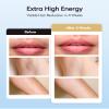 INNZA IPL Hair Removal with Ice Cooling Care Function for Women,Long-Lasting Results,999,999 Flashes Painless IPL Hair Remover, Hair Removal Device for Armpits Legs Arms Bikini Line view 4