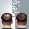 The Mossi London Hair Growth Shampoo for Thinning and All Hair Types - 6.7 Fl Oz (200ml) view 3