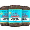 It's Pure Natural African Black Soap Bars with Acne Solution (Pack of 3) Organic Raw Soap for Face & Body, Acne Treatment & Dark Spot Remover [Made in Ghana] view 1