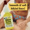 Urban ReLeaf Bikini Bump Treatment ! Shrink & Heal Irritation. Natural Shaving Remedy, Soothe & Soften Bumps, Scars, Ingrown Hairs, Razor Burn. Lighten Dark Spots. Made in USA. view 2