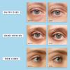 Enaskin Naturals Under Eye Patches for Dark Circles: 30 Pairs Retinol Collagen Eye Gels Mask - Reduce Wrinkles Puffy & Bags - Skin Treatment Pads - Anti Aging Moisturizer For Women (Blue) view 4
