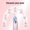 EZAGMWGFB Electric Vacuum Pore Cleaner Blackhead Remover Acne Facial Suction Machine for Deep Cleaning, Removing view 2