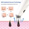 EZAGMWGFB Blackhead Remover Pore Vacuum, Acne Comedone Tool, USB Rechargeable with LED Display, 5 Suction Power and Probes for Deep Cleaning view 4