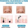 EZAGMWGFB Blackhead Remover, Pore Vacuum Cleanser, Electric Acne Extract Kit, USB Rechargeable Suction Tool, with LED Display, Suitable for Facial Skin view 2
