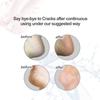 OJOINK Electric Feet Callus Remover, for Cracked Heels Callus and Dead Skin Electric Callus Remover view 2