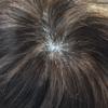 Hair System for Men Lace Front Mens Toupee Human Hair Piece French Lace Toupee for Men Poly Mens Hair Piece Bleached Knots Mens Wig(8X10"-100% Density, 3# DARK BROWN) view 4