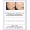 Korean Bakuchiol Concentrate Mix 2 Drops In Any Step of Your Skin Care Routine Retinol Alternative Non GMO Vegan Certificate Safe Natural Botanical Antioxidant Cold Pressed 10000ppm 30ml view 4