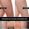 Dermasuri - Deep Exfoliating Body Scrub & Foot Scrub Set Bundle - Shower Body Exfoliator Glove, Spa Exfoliation Mitt & Exfoliating Feet Spray - Dry Skin Remover Sole File - Skin Care Spa Treatment Pro view 4