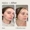 Topicals Faded Brightening and Clearing Serum | Reduces Discoloration, Post-Blemish Marks, Scars and Spots | Contains Kojic Acid and Niacinamide | Dermatologist-tested, Vegan, Cruelty-Free (0.5 Fl Oz) view 4