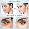 Microderm Machine with Spray Gun, mcwdoit Professional Facial Skin Care Beauty Device Home Salon (Suction Power: 0-68cmhg) view 2
