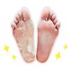 Cettua Clean and Simple Exfoliating Foot Mask 5 PACK, Foot Peeling Mask, Dermatologist Tested, No Paraben, No Pigment, No Talc view 2