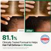 ROOTON Alpha Erguen Womens Hair Loss Care Treatment, Vegan Formula for Dual Scalp & Hair Cortex Repair, Strengthens, Restores & Nourishes Damaged Hair, 500ml / 16.9 fl oz view 2