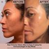 IMMUNOCOLOGIE Exfoliating Lotion - Gentle Face Exfoliator Lotion with Glycolic and Lactic Acids, Achieve Minimized Pores and Radiant Skin - 3.4 fl oz/100 ml view 4