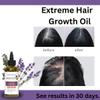 Extreme Hair Growth Oil - Biotin Hair Oil, Infused with Rosemary and MSM Formula for Thinning Hair, Fast Results, Lavender & Eucalyptus Scent, for Male and Female Hair loss view 3