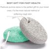 Natural Foot Pumice Stone for Feet, Borogo 2-Pack Lava Pedicure Tools Hard Skin Callus Remover for Feet and Hands -White&Green view 3