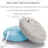 Natural Foot Pumice Stone for Feet, Borogo 2-Pack Lava Pedicure Tools Hard Skin Callus Remover for Feet and Hands - White&Blue view 3