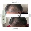 MELMO Hair Growth for Hair Loss- 100ml Hair Thickening, Hydrating Hair Care Products for Women and Men+Hair Volumizer, Perfect Hair Treatment for Hair Care- All Hair Types view 3