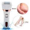 XARONF Electric Foot File Rechargeable, IPX7 Waterproof Portable Pedicure Tools Kit for Dead Hard Cracked Dry Skin Removal, 3 Rollers view 3