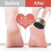 XARONF Electric Callus Remover for Feet, Rechargeable Foot File Hard Skin Remover, for Cracked Heels Calluses&Dead Skin, 2 Speed, Easy to Clean view 3