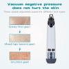XARONF Blackhead Remover Pore Vacuum, Facial Pore Cleaner,Electric Acne Extractor Tool, USB Rechargeable Blackhead Vacuum Kit for Women & Men view 4