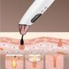 XARONF Blackhead Vacuum Remover Acne Remover,Facial Pore Cleanser Electric Acne, 5 Adjustable Suction Power, USB Rechargeable, Blackhead Extractor Tool for Women and Men view 4