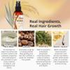 NEW Fermented Rice Water for Hair Growth - Infused with Rosemary, Biotin, Caffeine, Keratin Vegan Non-Greasy Spray Naturally Thicker, Longer, Softer Men & Women (4 fl oz) view 2