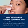 Hero Cosmetics Pore Release Blackhead Clearing Solution, 3.38 Fl Oz view 4