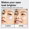 I DEW CARE Hydrogel Eye Patch - Starlit Kitten | Korean Under Eye Patches for dark circles and puffy eyes, Smooths Puffy Eyes, Eye wrinkle patches, Dermatologically Tested, (5 EA) view 3