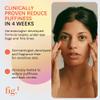 Fig.1 Vitamin C Eye Cream for Dark Circles, Puffiness & Wrinkles | Under Eye Cream for Women & Men | Glowing Eye Treatment | Refillable Anti Aging Moisturizer for Fine Lines view 2