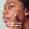 Mighty Patch Micropoint Large Hydrocolloid Pimple Patches for Face Blemishes from Hero Cosmetics, Acne Stickers for Early Stage Zits & Hidden Pimples, 395 Proprietary Micropoints, 8 Count view 2