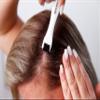 REVIVV Roller for Hair Rejuvenation  0.25mm Roller for Scalp, Hair, Beard, Skin  45 Day Supply view 3