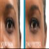 BE YOU SKIN | Skin Perfecting Conceal | RICH view 3