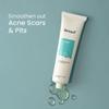METROL RE' EQUIL Pitstop Gel for Acne Scars Removal and Acne Pits Removal - 30g view 2