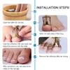 Ingrown Toenail Corrector Professional Ingrown Toenail Lifter Practical Toe Clamp for Ingrown Toenail Treatment view 2