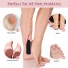 30 Pcs Foot File Dead Skin Foot Scrubber Remover Pedicure Double Sided Callus Heel Foot Scraper Professional Foot Exfoliator Feet Rasp for Smoothing Hard Rough Skin Kit, Pink, White, 7.87 x 1.77 Inch view 4