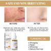 2 Pack Turmeric Dark Spot Corrector Serum, Natural Turmeric Dark Spot Corrector Serum for Face, Skin Care Moisturizing Repair (30mL/1.01 f.oz) view 2