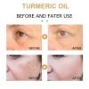 2 Pack Turmeric Dark Spot Corrector Serum, Natural Turmeric Dark Spot Corrector Serum for Face, Skin Care Moisturizing Repair (30mL/1.01 f.oz) view 4