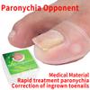 2pcs Silicone Ingrown Toenail Correcting Tool, Pain Relief Paronychia Treatment Corrector, Toenail Corrector, Wholesale Business view 3