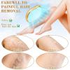 Crystal Hair Eraser,Simple and Fast Magic Hair EraserSuitable for the Painless Hair Eraser for Women and Men's Arms, Legs and Back Crystal Hair RemoverEquipped with a Folding Nail File view 3