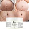 Stretch Marks and Scars Removal Cream for Pregnancy - Scars Repair, Abdominal Firming, and Gentle Stretch Marks Eradication Skincare Body view 1