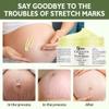 Stretch Marks and Scars Removal Cream for Pregnancy - Scars Repair, Abdominal Firming, and Gentle Stretch Marks Eradication Skincare Body view 3