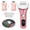 Electric Foot Callus Remover, Portable Rechargeable Electronic Foot Scrubber Feet Care File for Hard Cracked Dead Skin and Powerful Pedicure Spa (Pink) view 4