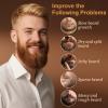 XIKEZAN 5 Pack Beard Oil Set w/Sandalwood, Orange, Vanilla, Cedarwood, Unscented for Beard Care, Moisturizing, Soften,Birthday Gifts for Men Him Dad Husband Christmas Gifts Stocking Stuffers view 3
