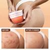 Butt Acne Clearing Treatment, Body Cream for Back, Buttocks, Thigh & Chest Acne, Skin Clearing Lotion for Men & Women 5.46 oz view 3