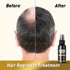 Rice Water for Hair Growth -Black Rice Water Hair Growth Spray for Thinning Hair and Hair Loss, All Natural Vegan Leave in Conditioner Spray Hair Care Products for Women & Men (1.7Fl.Oz) view 2