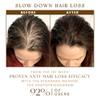 VEMART Hair'GRO SerumGRO Hair Serum for Thicker,Biotin Hair Regrowth Oil Prevent Hair Loss and Natural Serum for Thicker (Color : 1pcs) view 4