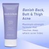 Butt Acne Clearing Treatment, Maximum Strength Body Cream for Back, Buttocks, Thigh & Chest Acne Removal, Skin Clearing Lotion for Men & Women, Foaming Cleanser for Bacne & Cystic Acne view 4