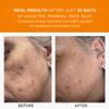 Andalou Naturals Dark Spot Corrector, Complexion Enhancing Face Serum with Vitamin C, May Help Hyperpigmentation, Reduce the Appearance of Acne Scars, Age Spots & UV Damage, 1 Oz view 4