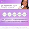 Spa Sciences - LEXI - Painless Permanent IPL Hair Removal System - FDA Cleared with 999,999 flashes, Auto Flash, and Skin Sensor view 2